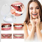 Clip-on dental veneer | Tooth-supported design, no adhesive | For a radiant smile without a dentist visit