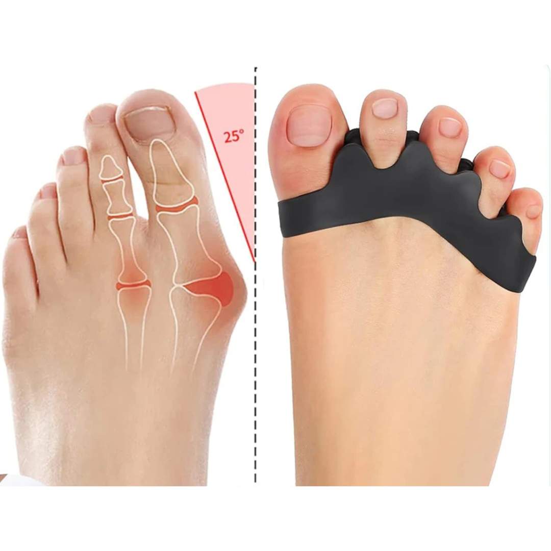 FlexAlign Toe Spacer | Toe Realignment and Pain Relief – Ideal for Bunions - Overlapping Toes - and Foot Comfort Boneros