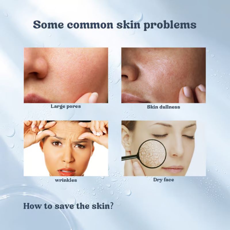 Hydrating Facial Mask Gift Set for Smooth Skin Repair