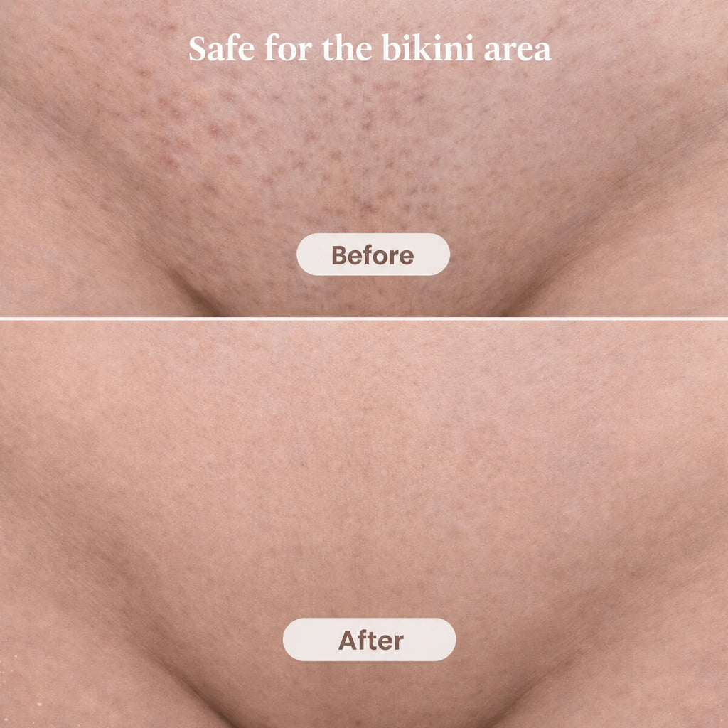 Intimate trimmer for women with 2 attachments | IntimLisse