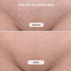 Intimate trimmer for women with 2 attachments | IntimLisse