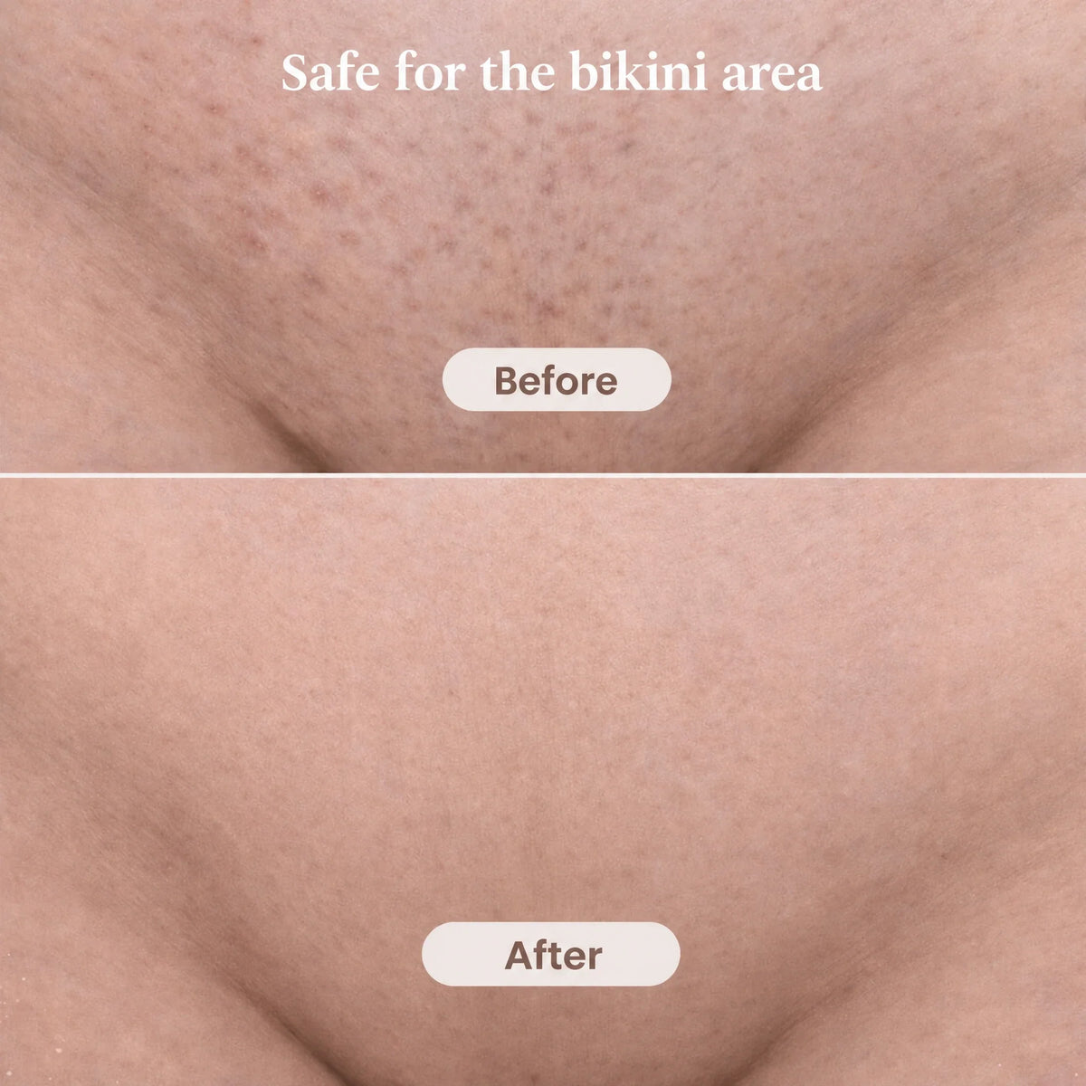 Intimate trimmer for women with 2 attachments | IntimLisse