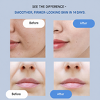 Lifting face strips | Instantly smooth & tighten | Anti-wrinkle care without surgery | YouthLift Renew
