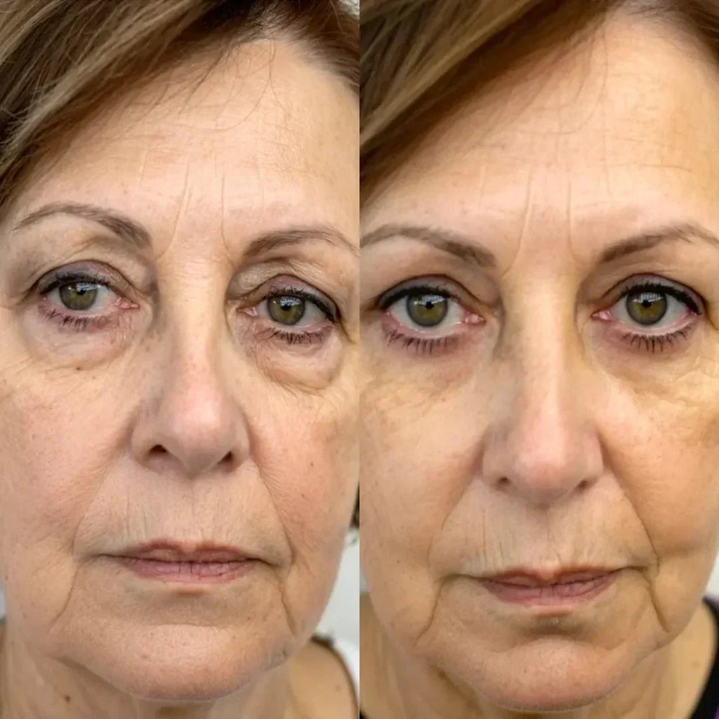 LumiLift 2-in-1 Eye Rejuvenator — Red Light, Microcurrent, 10-Minute