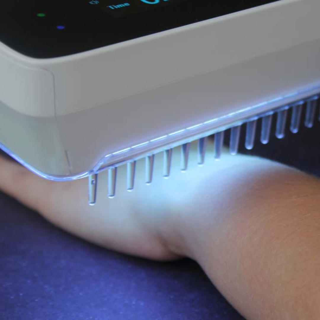 Philips Portable UVB Phototherapy Device for Psoriasis 9W