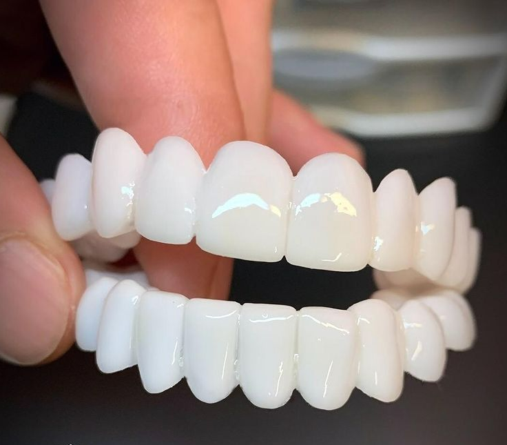 Professional Cosmetic Veneers for a Confident and Beautiful Smile
