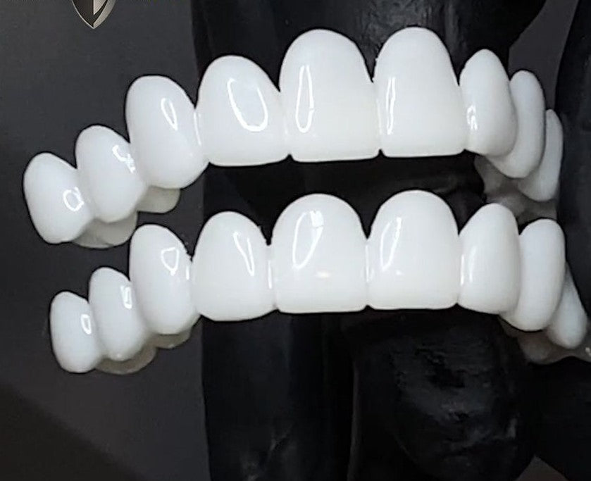 Professional Cosmetic Veneers for a Confident and Beautiful Smile