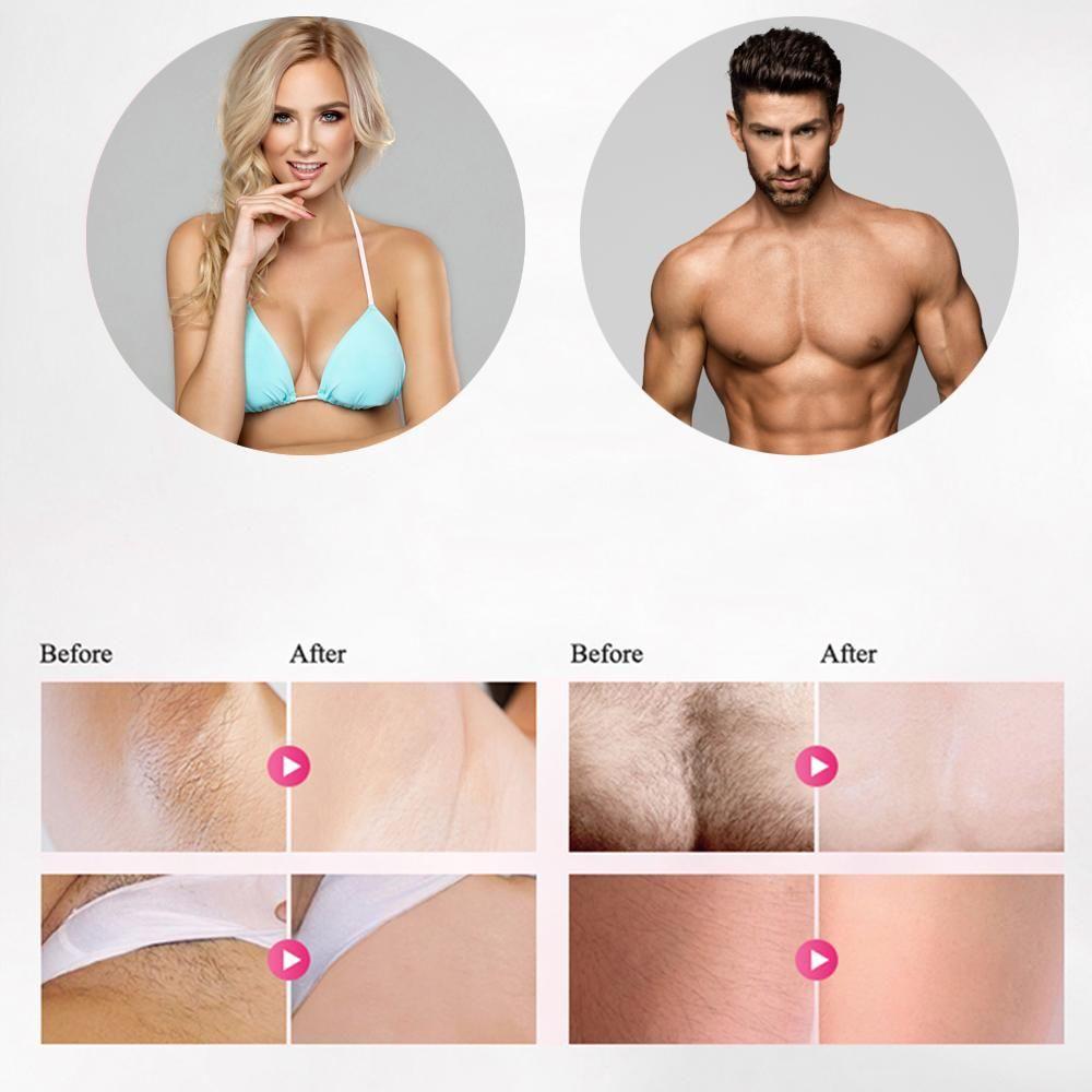 Professional IPL Epilator for Laser Hair Removal