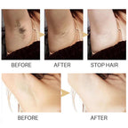 Smoothify™ Hair Removal Serum | Permanent & Painless