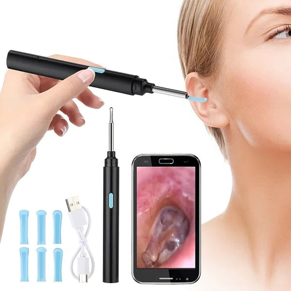 Wireless Ear Cleaning Camera Scope, 20x Magnification, Spoon Tip